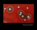 streptococcus pyogenes